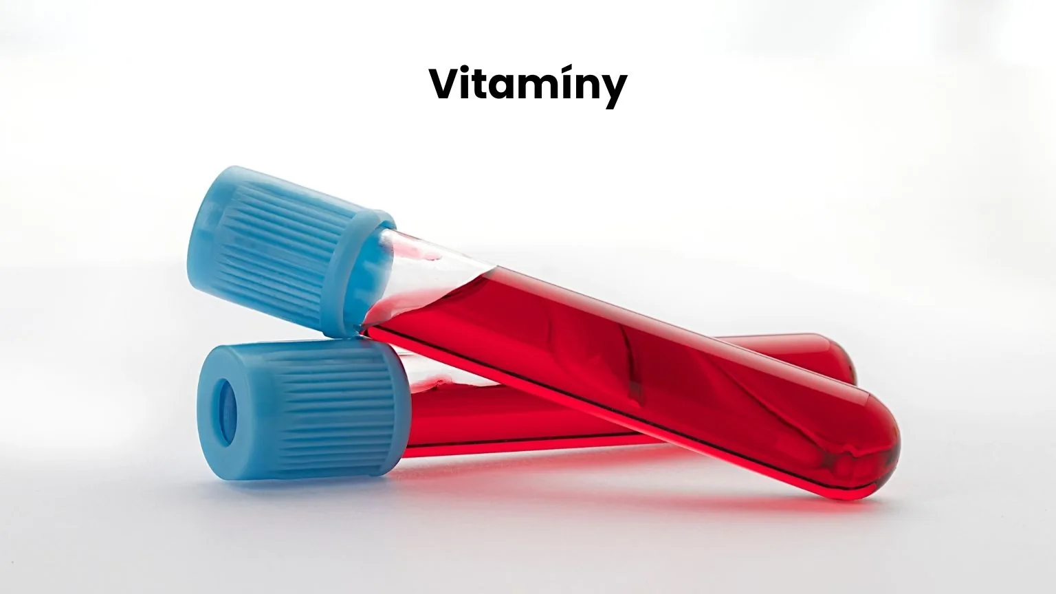 Krevní testy na vitamíny - rozbor hladin vitamínů v krvi