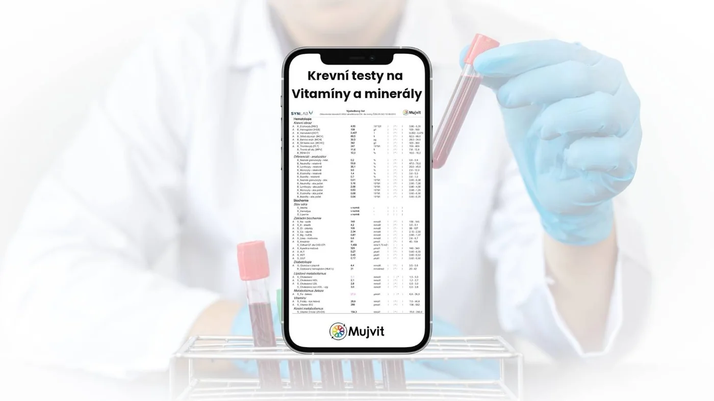Krevní testy Mujvit na vitamíny a minerály
